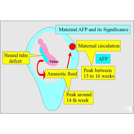 alpha fetoprotein (afp), maternal marker test